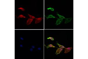 ABIN7094098 and ABIN7098142 staining Hela cells by IF/ICC. (C14orf102 抗体  (Internal Region))