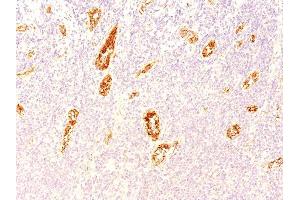 Formalin-fixed, paraffin-embedded human Pancreas stained with vWF Mouse Monoclonal Antibody (3E2D10). (VWF 抗体  (AA 845-949))