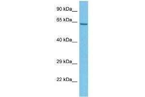 Host:  Rabbit  Target Name:  MBOAT1  Sample Tissue:  Human U937 Whole Cell  Antibody Dilution:  1ug/ml (MBOAT1 抗体  (N-Term))