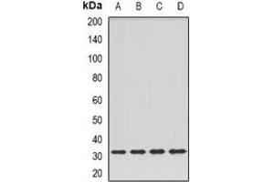 Western blot analysis of DPM1 expression in Hela (A), SKOV3 (B), mouse kidney (C), rat liver (D) whole cell lysates. (DPM1 抗体)