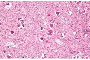 Immunohistochemistry (IHC) image for anti-Ribosomal Protein S6 Kinase, 90kDa, Polypeptide 5 (RPS6KA5) (AA 551-600) antibody (ABIN2879102)