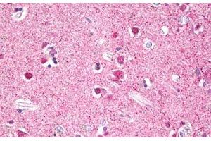Anti-RPS6KA5 / MSK1 antibody IHC staining of human brain, cortex neurons. (MSK1 抗体  (AA 551-600))