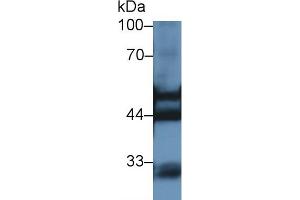 Western blot analysis of Rat Kidney lysate, using Rat KRT7 Antibody (1 µg/ml) and HRP-conjugated Goat Anti-Rabbit antibody ( (Cytokeratin 7 抗体  (AA 255-393))
