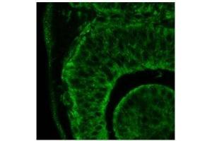 Itgb1 antibody used at a dilution of 1:500 to detect human eye (day 24). (ITGB1 抗体  (C-Term))