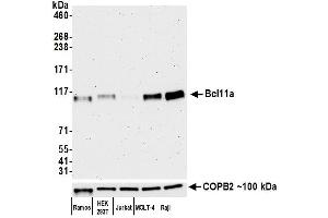 Western Blotting (WB) image for anti-B-Cell CLL/lymphoma 11A (Zinc Finger Protein) (BCL11A) (AA 785-835) antibody (ABIN7452847) (Recombinant BCL11A 抗体  (AA 785-835))