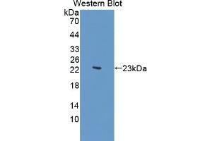 Detection of Recombinant KDM4A, Human using Polyclonal Antibody to Lysine Specific Demethylase 4A (KDM4A) (KDM4A 抗体  (AA 141-310))