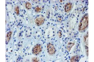 Immunohistochemical staining of paraffin-embedded Human Kidney tissue using anti-DOK7 mouse monoclonal antibody. (DOK7 抗体)