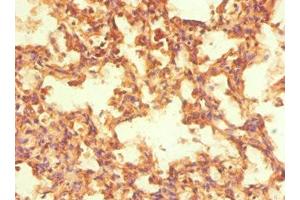 Immunohistochemistry of paraffin-embedded human lung tissue using ABIN7161902 at dilution of 1:100 (NR2C1 抗体  (AA 1-240))