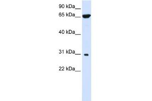 WB Suggested Anti-PTPLAD2 Antibody Titration:  0.