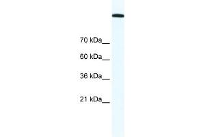 WB Suggested Anti-TOP2A Antibody Titration:  1. (Topoisomerase II alpha 抗体  (C-Term))