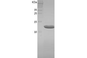 Western Blotting (WB) image for Fatty Acid Binding Protein 6, Ileal (FABP6) (AA 2-128) protein (His tag) (ABIN7122898)
