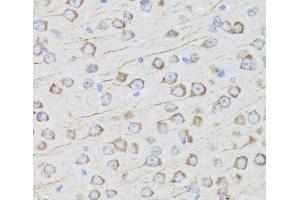 Immunohistochemistry of paraffin-embedded Mouse brain using MIP Polyclonal Antibody at dilution of 1:100 (40x lens). (Mip 抗体)