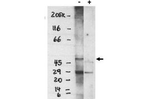 Image no. 1 for anti-Sphingosine-1-Phosphate Receptor 4 (S1PR4) (C-Term) antibody (ABIN265012) (S1PR4 抗体  (C-Term))