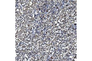 IHC analysis of DDX1 using anti-DDX1 antibody (ABIN7602051).