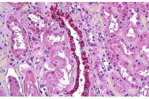 Human Kidney, Renal Duct: Formalin-Fixed, Paraffin-Embedded (FFPE) (TGFBI 抗体  (AA 119-131))