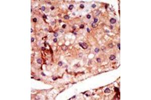 Image no. 1 for anti-6-phosphofructo-2-Kinase/fructose-2,6-Biphosphatase 2 (PFKFB2) (N-Term) antibody (ABIN360654) (PFKFB2 抗体  (N-Term))