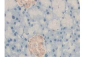 Detection of BCKDK in Rat Pancreas Tissue using Polyclonal Antibody to Branched Chain Alpha-Ketoacid Dehydrogenase Kinase (BCKDK) (BCKDK 抗体  (AA 44-223))