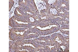 IHC analysis of RPL36 using anti-RPL36 antibody (ABIN7602917).