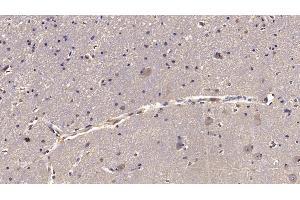 Detection of RELN in Human Cerebrum Tissue using Monoclonal Antibody to Reelin (RELN) (Reelin 抗体  (AA 26-190))