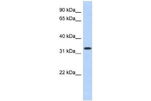 MPPED2 antibody used at 1 ug/ml to detect target protein. (MPPED2 抗体  (N-Term))