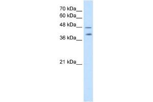 PSG1 antibody used at 2. (PSG1 抗体  (C-Term))