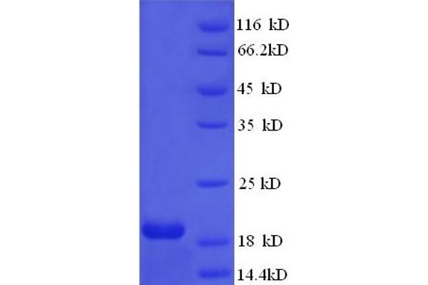 HPV16 E7 Protein (AA 1-105, full length) (His tag)