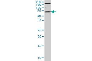 UCKL1 monoclonal antibody (M01), clone 8D4 Western Blot analysis of UCKL1 expression in NIH/3T3 . (UCKL1 抗体  (AA 301-400))