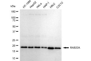 Western blotting analysis using RAB22A antibody (ABIN7800090).