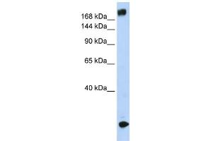WB Suggested Anti-SCN5A Antibody Titration:  0. (SCN5A 抗体  (N-Term))