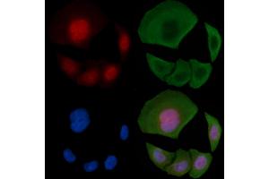 ABIN6255629 and ABIN6267394 staining Hela cells(30 min of UV treatment) by IF/ICC. (RPA2 抗体  (pThr21))