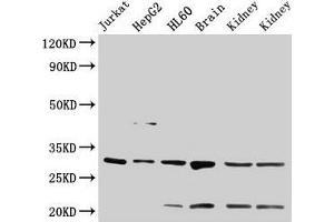 Western Blot Positive WB detected in: Jurkat whole cell lysate, HepG2 whole cell lysate, HL60 whole cell lysate, Rat brain tissue, Rat kidney tissue, Mouse kidney tissue All lanes: YWHAB antibody at 4 μg/mL Secondary Goat polyclonal to rabbit IgG at 1/50000 dilution Predicted band size: 29, 28 kDa Observed band size: 29 kDa (YWHAB 抗体  (AA 1-246))