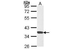 WB Image Sample (30 ug of whole cell lysate) A: Hela 10% SDS PAGE antibody diluted at 1:1000 (CDK6 抗体)