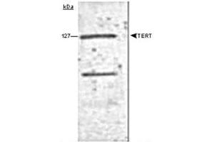 Western blot analysis of human TERT using TERT monoclonal antibody, clone 2D8 . (TERT 抗体)