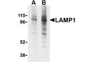 AP20059PU-N CD107a/LAMP1 antibody staining of EL4 cell lysate by Western Blotting at (A) 1 and (B) 2 μg/ml. (LAMP1 抗体)