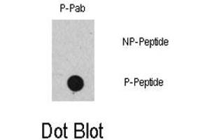 Dot blot analysis of RAF1 (phospho S471) polyclonal antibody  on nitrocellulose membrane. (RAF1 抗体  (pSer471))