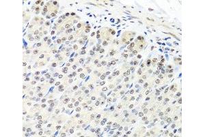 Immunohistochemistry of paraffin-embedded Mouse stomach using CNOT8 Polyclonal Antibody at dilution of 1:100 (40x lens). (CNOT8 抗体)