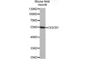 Western Blotting (WB) image for anti-Chemokine (C-X3-C Motif) Receptor 1 (CX3CR1) antibody (ABIN1679440) (CX3CR1 抗体)