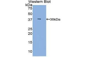 Western Blotting (WB) image for anti-Mannose-Binding Lectin (Protein C) 2, Soluble (MBL2) (AA 42-96) antibody (ABIN1859768) (MBL2 抗体  (AA 42-96))