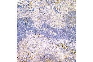 IHC analysis of IGLL1 using anti-IGLL1 antibody (ABIN6719329).