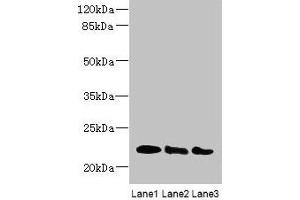 Western blot All lanes: ARL8B antibody at 4 μg/mL Lane 1: Mouse brain tissue Lane 2: NIH/3T3 whole cell lysate Lane 3: Jurkat whole cell lysate Secondary Goat polyclonal to rabbit IgG at 1/10000 dilution Predicted band size: 22, 19 kDa Observed band size: 22 kDa (ARL8B 抗体  (AA 20-186))