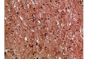 Immunohistochemical analysis of paraffin-embedded Human-brain, antibody was diluted at 1:100 (IL17D 抗体  (AA 141-190))