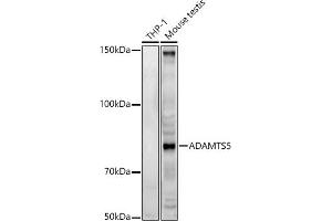 Western blot analysis of extracts of various cell lines, using  antibody (ABIN3016805, ABIN3016806, ABIN3016807 and ABIN6219845) at 1:500 dilution. (ADAMTS5 抗体  (AA 731-930))
