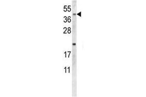 Western blot analysis of NEU1 antibody and MDA-MB231 lysate. (NEU1 抗体  (AA 11-40))