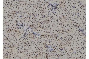 ABIN6267162 at 1/100 staining Mouse kidney tissue by IHC-P.