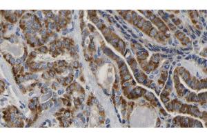 anti-Inositol Polyphosphate Phosphatase-Like 1 (INPPL1) (pTyr986), (pTyr987) antibody