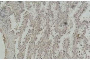 Immunohistochemistry (Paraffin-embedded Sections) (IHC (p)) image for anti-cAMP Responsive Element Binding Protein 1 (CREB1) antibody (ABIN7250266)