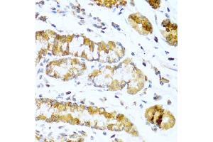 Immunohistochemistry of paraffin-embedded human stomach using GCG antibody (ABIN5970469) at dilution of 1/100 (40x lens). (Glucagon 抗体)