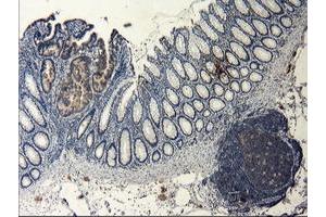 Immunohistochemical staining of paraffin-embedded Human colon tissue using anti-LGR5 mouse monoclonal antibody. (LGR5 抗体  (AA 250-550))
