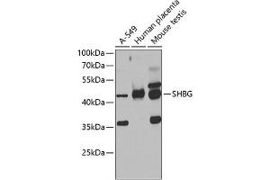 Western blot analysis of extracts of various cell lines, using SHBG antibody (ABIN6129327, ABIN6147736, ABIN6147737 and ABIN6223329) at 1:1000 dilution. (SHBG 抗体  (AA 30-170))