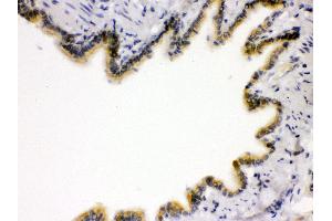 Anti- RAGE Picoband antibody, IHC(P) IHC(P): Rat Lung Tissue (RAGE 抗体  (N-Term))